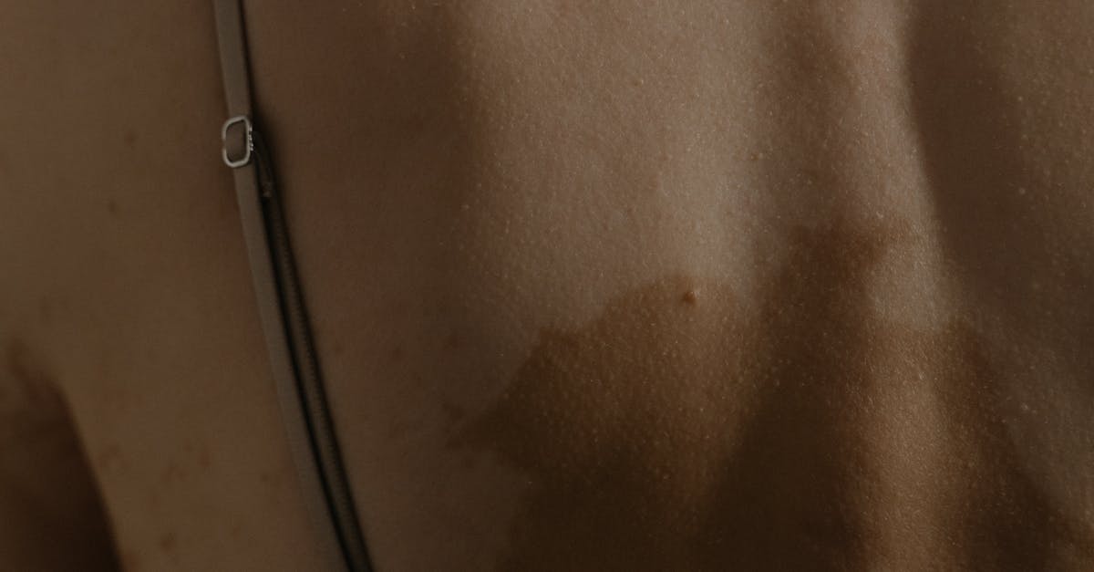 Gut, Bacteria & Vitiligo